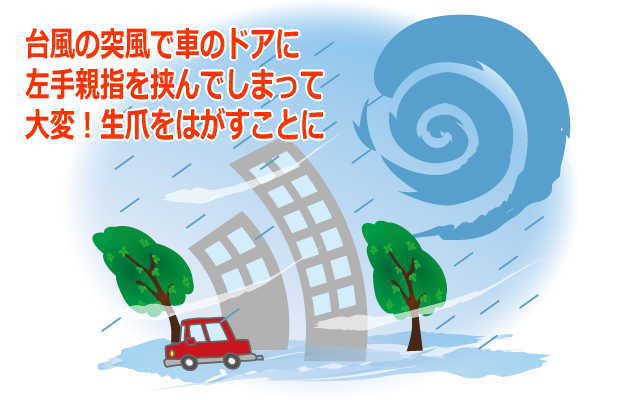 台風で生爪をはがす